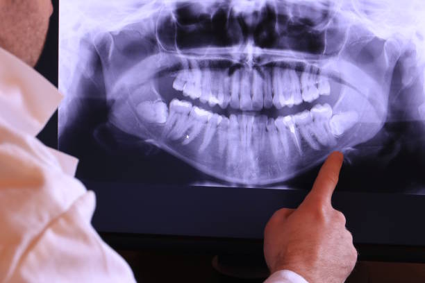 Best Urgent Dental Care for Toothache in Katy, TX