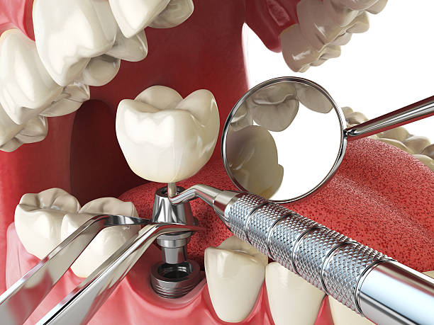 Best Weekend Emergency Dentist in Katy, TX